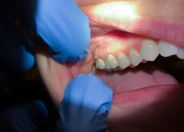 Best Dentist Open Late Near Me  in Line Acres, MO