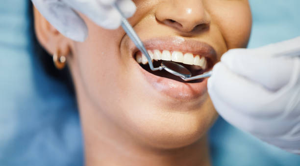 Best Broken Tooth Emergency  in Line Acres, MO